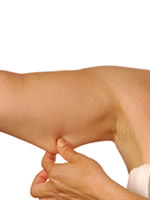 Arm Lift - Dr. Mahabat